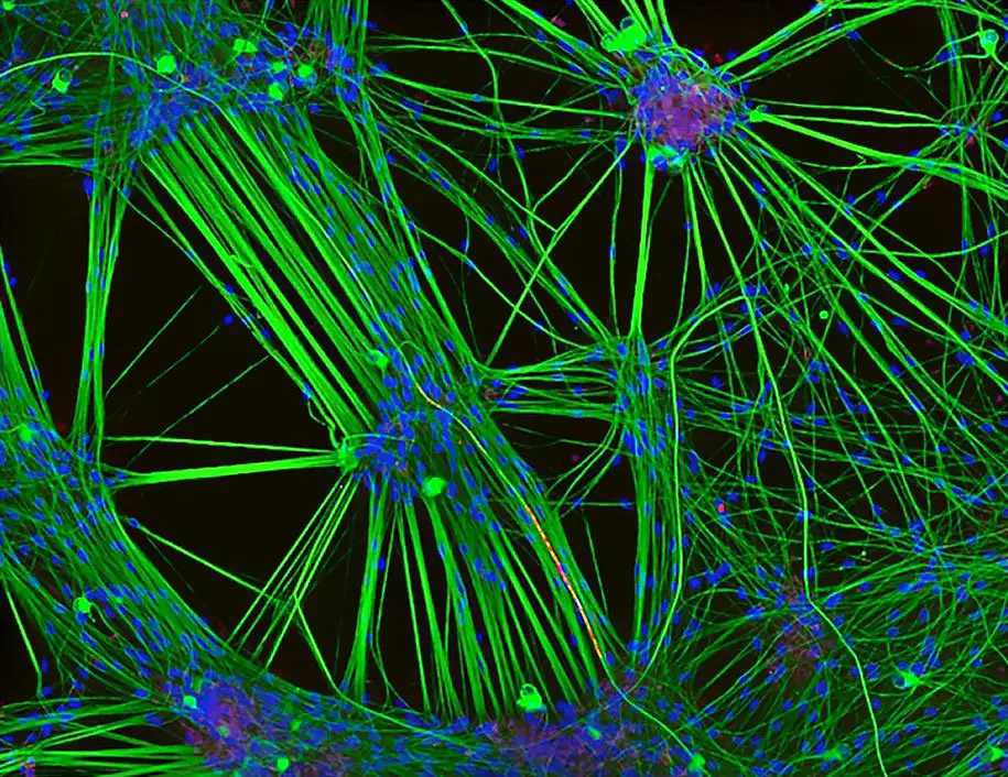 20 лучших снимков фотоконкурса «Nikon Small World 2016»