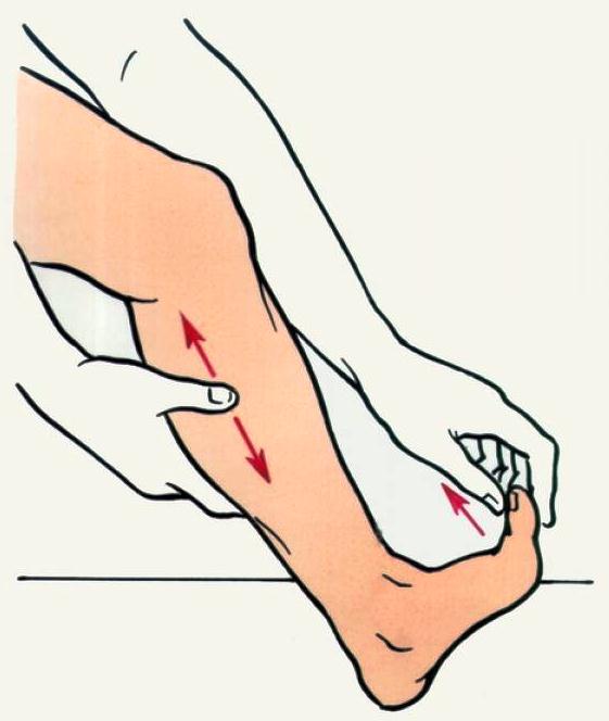 Если сводит стопу или как помочь себе при мышечной судороге?