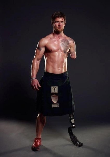 Sergeant Noel Gallaway lost an arm and a leg in combat.
