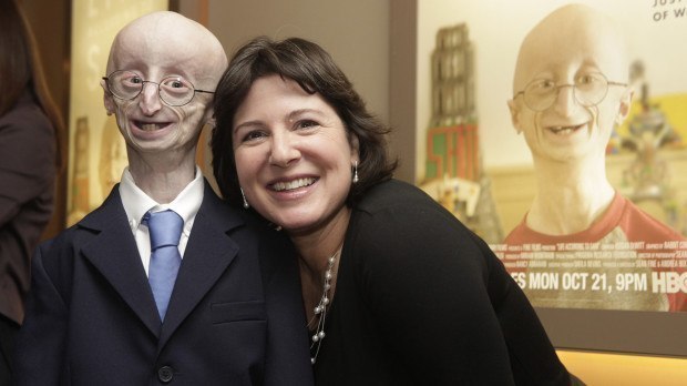 17-year-old boy Sam Burns died in the United States from a rare disease that causes the body to age prematurely.