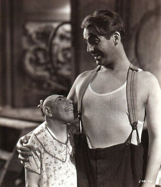 施利茨·苏尔蒂斯。小头畸形患者——那些拥有较小颅骨，因而大脑体积也相对较小的人们。