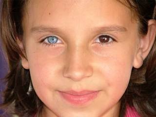 异色瞳症……人类众多奇妙而独特的现象之一便是异色瞳症，也就是同一个人拥有不同颜色的眼睛。