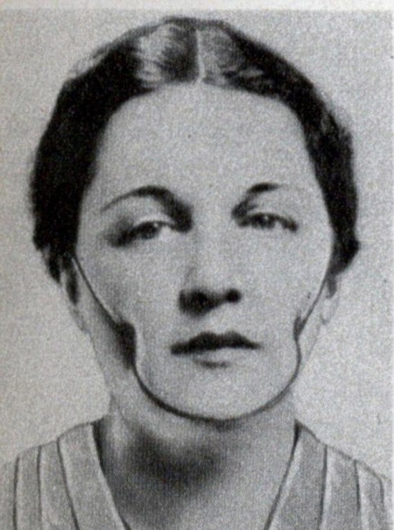 Особенности процедур красоты столетней давности. Недавно мы знакомились с особенностями женского фитнеса столетней давности, а сегодня устроим экскурсию по косметическим салонам начала прошлого века. Каким только процедурам не подвергались представительни - 5