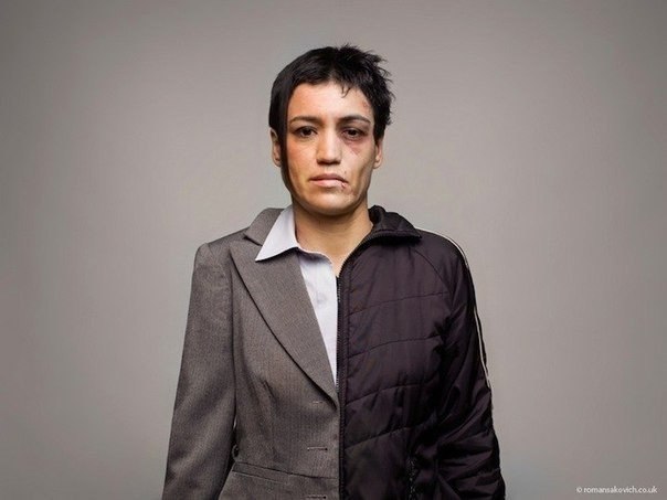 Шокирующие «до» и «после» портреты последствия наркотиков. Результат, как говорится, «на лицо»