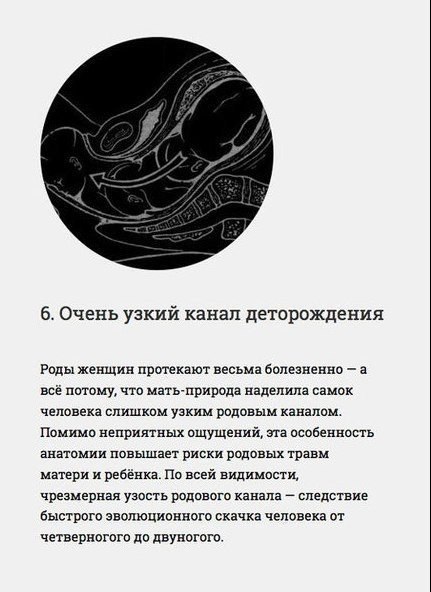 Инженерные ошибки человеческого организма - 5