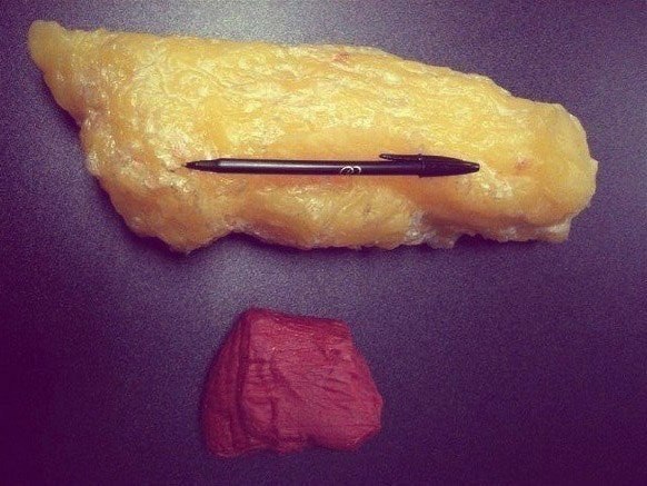 Так выглядят 1.5 кг жира и 1.5 кг мышц