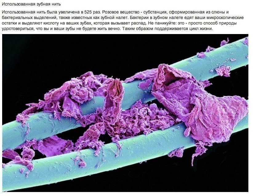 Удивительные микроскопические фотографии. Еще около столетия тому назад фотографическая технология была ограничена, а фотографии представляли собой плохую копию наших собственных чувств. Сегодня у нас есть технология, которая позволяет фотографировать нам - 7