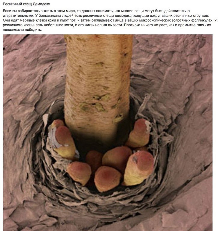 Удивительные микроскопические фотографии. Еще около столетия тому назад фотографическая технология была ограничена, а фотографии представляли собой плохую копию наших собственных чувств. Сегодня у нас есть технология, которая позволяет фотографировать нам - 5