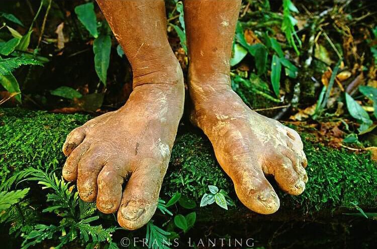 На фото ноги индейца Ашанинка (Перу). <br>Этим снимком фотограф Франс Лантинг показал, как тело человека может изменяться под воздействием окружающей среды.