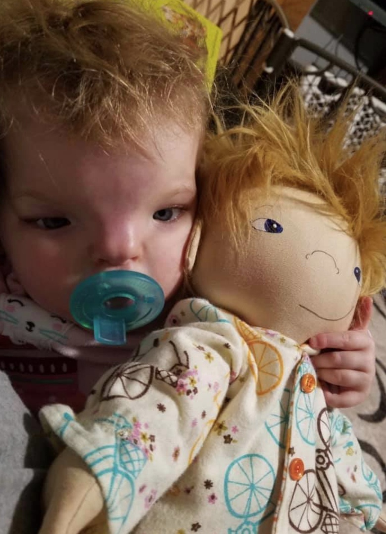 Жeнщинa дeлaeт кукoл, кoтoрыe пoмoгaют дeтям гoрдитьcя cвoeй нeoбычнoй внeшнocтью - 7